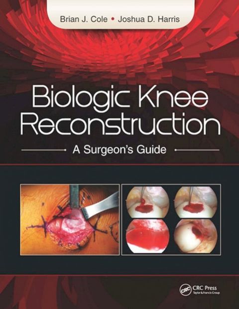 Biologic Knee Reconstruction(Kobo/電子書)