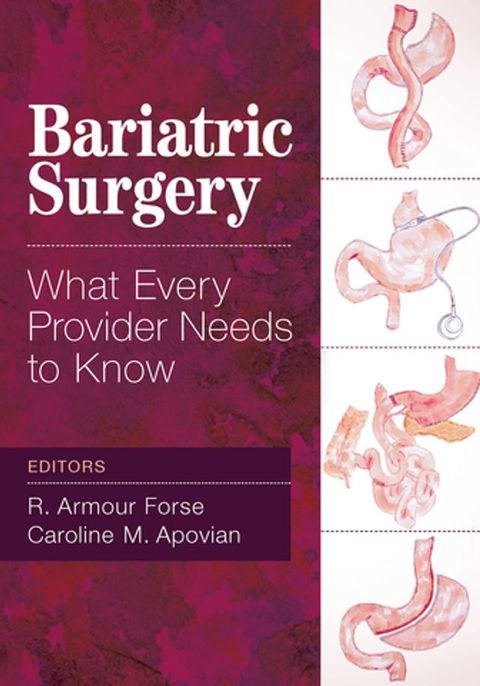 Bariatric Surgery(Kobo/電子書)