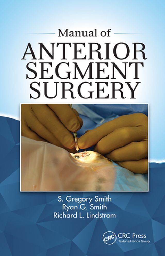  Manual of Anterior Segment Surgery(Kobo/電子書)