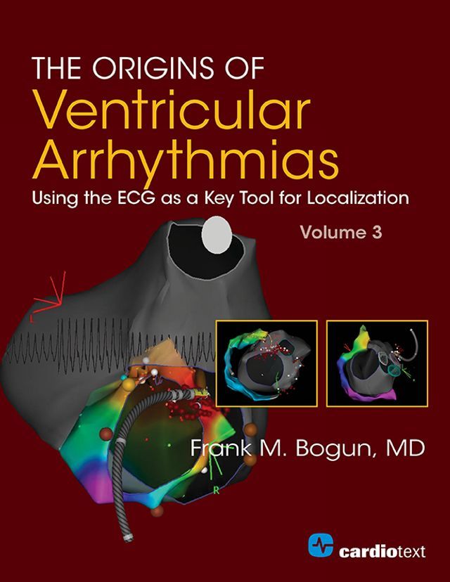  The Origins of Ventricular Arrhythmias: Using the ECG as a Key Tool for Localization, Volume 3(Kobo/電子書)