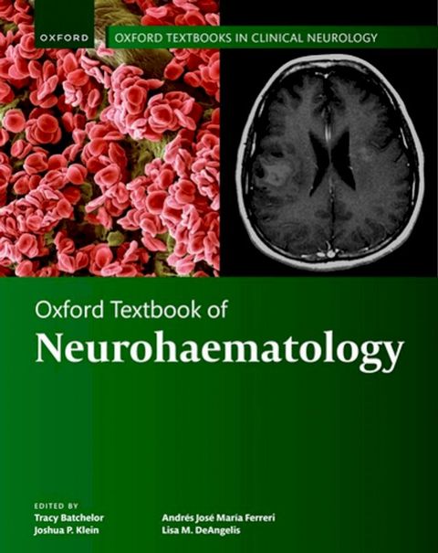 Oxford Textbook of Neurohaematology(Kobo/電子書)