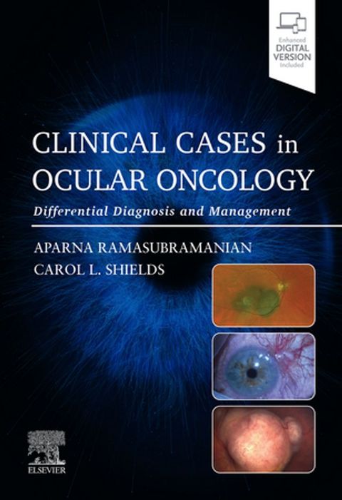 Clinical Cases in Ocular Oncology(Kobo/電子書)