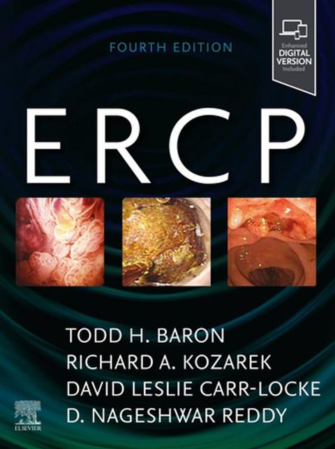 ERCP(Kobo/電子書)