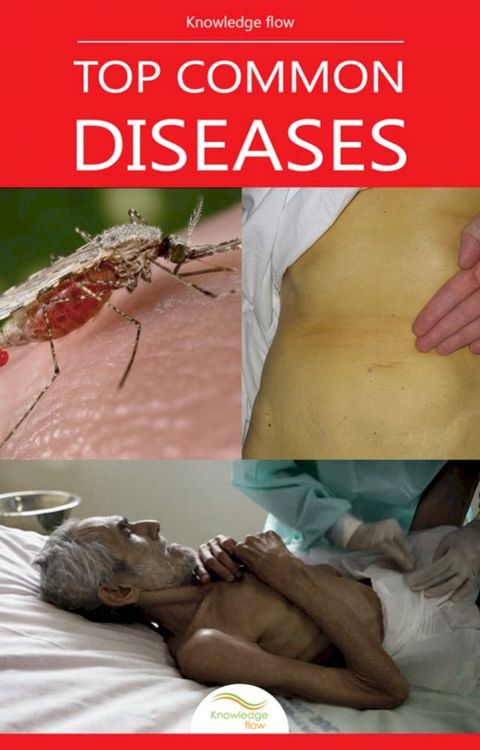 Top Common Diseases