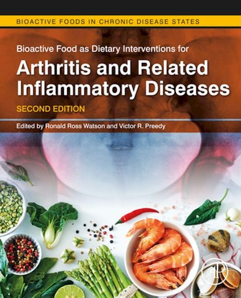 Bioactive Food as Dietary Interventions for Arthritis and Related Inflammatory Diseases(Kobo/電子書)