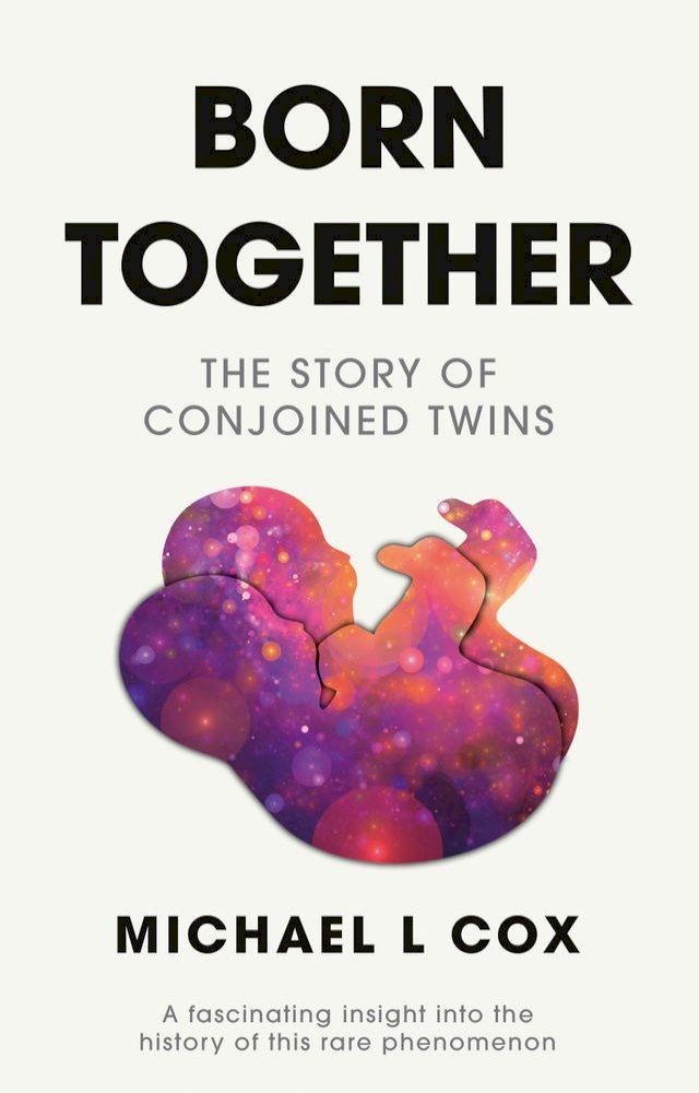  Born Together: The Story of Conjoined Twins(Kobo/電子書)