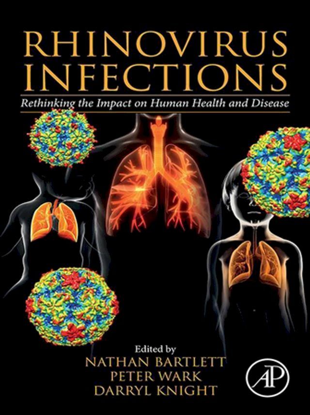  Rhinovirus Infections(Kobo/電子書)