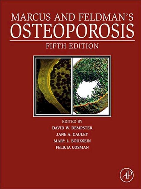 Marcus and Feldman's Osteoporosis(Kobo/電子書)