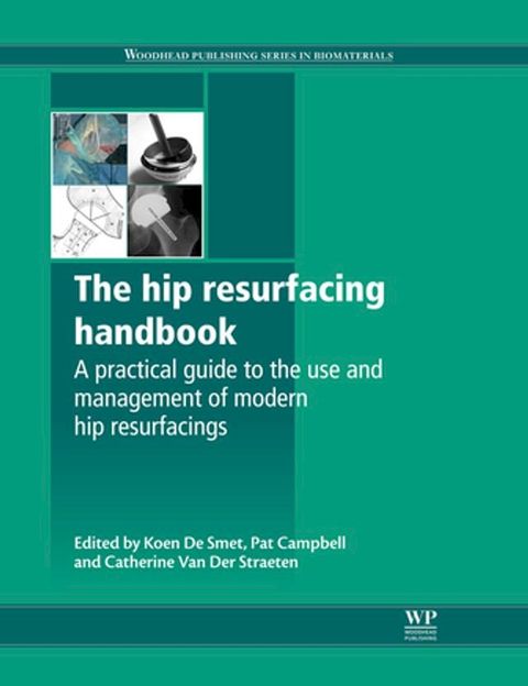 The Hip Resurfacing Handbook(Kobo/電子書)