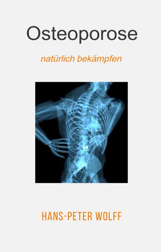  Osteoporose nat&uuml;rlich bek&auml;mpfen(Kobo/電子書)