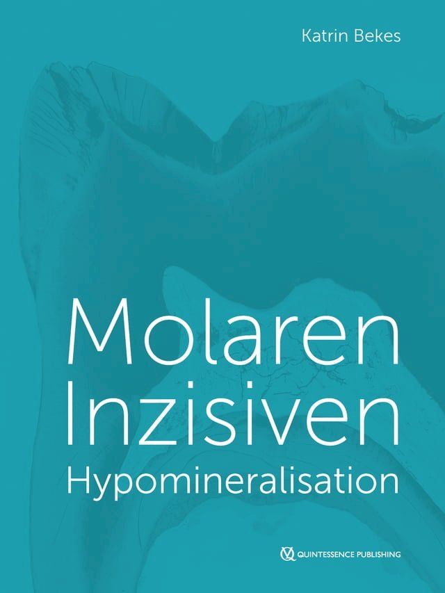  Molaren-Inzisiven-Hypomineralisation(Kobo/電子書)