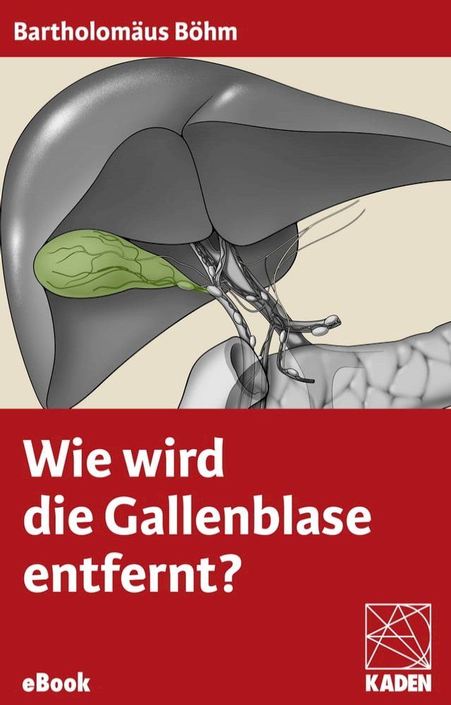  Wie wird die Gallenblase entfernt?(Kobo/電子書)