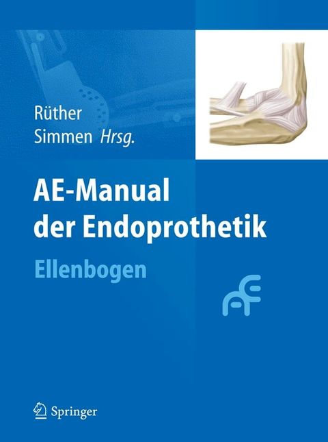 AE-Manual der Endoprothetik(Kobo/電子書)