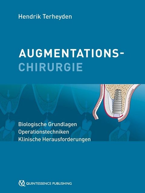 Augmentationschirurgie(Kobo/電子書)