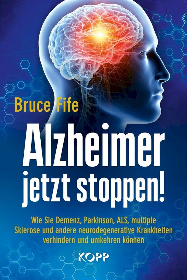  Alzheimer jetzt stoppen!(Kobo/電子書)