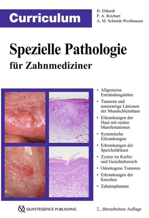 Curriculum Spezielle Pathologie f&uuml;r Zahnmediziner(Kobo/電子書)