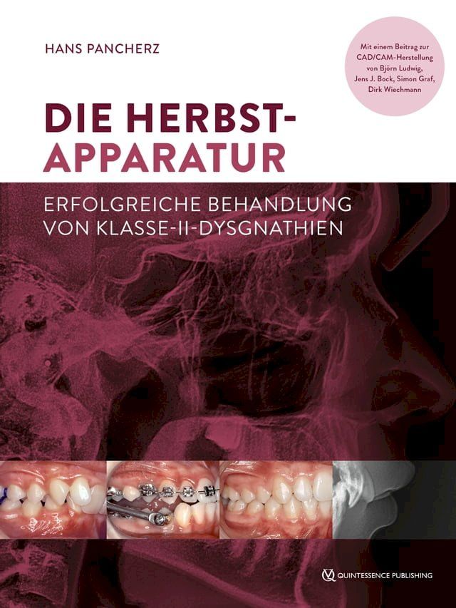  Die Herbst-Apparatur(Kobo/電子書)