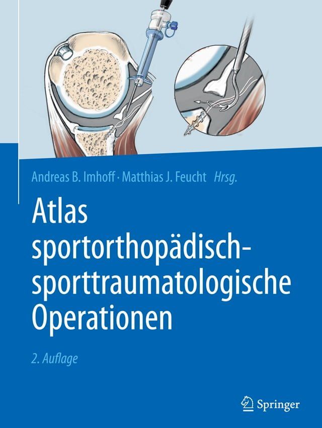  Atlas sportorthop&auml;disch-sporttraumatologische Operationen(Kobo/電子書)