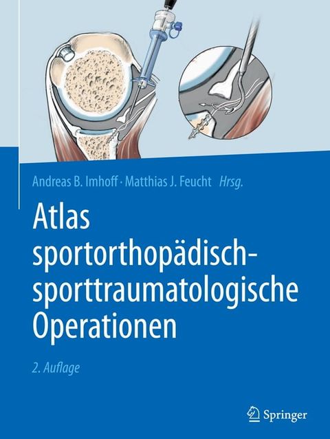 Atlas sportorthop&auml;disch-sporttraumatologische Operationen(Kobo/電子書)