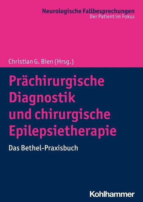 Pr&auml;chirurgische Diagnostik und chirurgische Epilepsietherapie(Kobo/電子書)