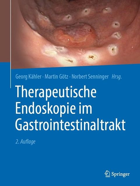 Therapeutische Endoskopie im Gastrointestinaltrakt(Kobo/電子書)