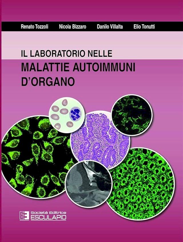  Il laboratorio nelle malattie autoimmuni d'organo(Kobo/電子書)