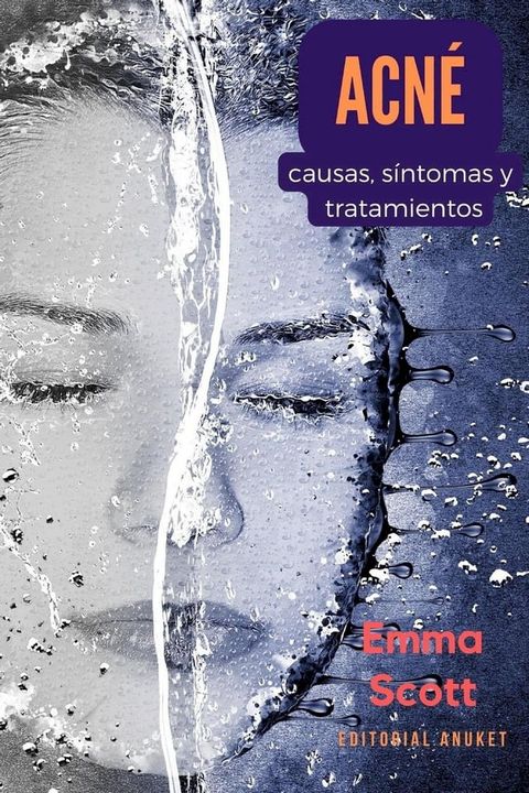 Acné: Causas, Síntomas y Tratamientos(Kobo/電子書)