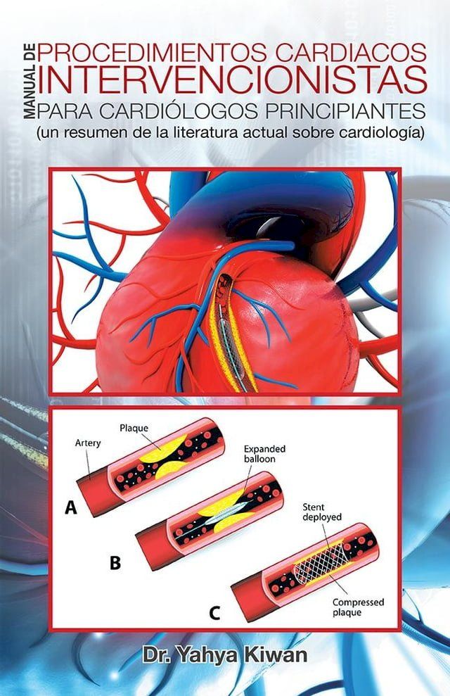  Manual De Procedimientos Cardiacos Intervencionistas Para Cardi&oacute;logos Principiantes(Kobo/電子書)