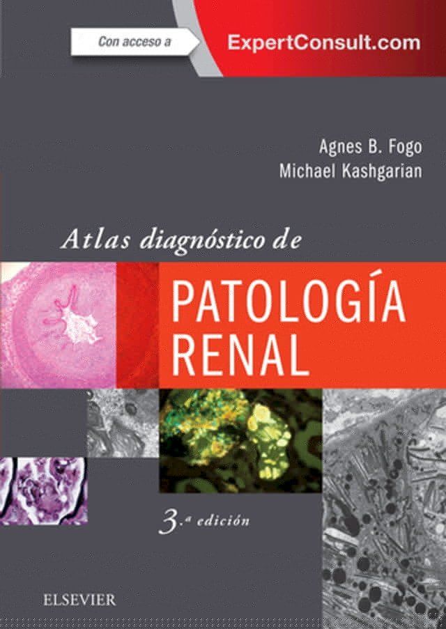  Atlas diagnóstico de patología renal(Kobo/電子書)