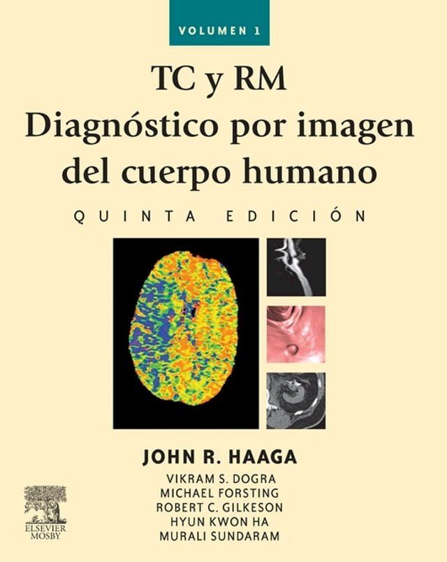  TC y RM. Diagnóstico por imagen del cuerpo humano(Kobo/電子書)