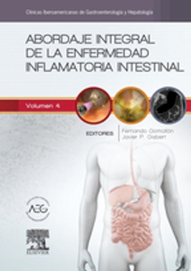  Abordaje integral de la enfermedad inflamatoria intestinal(Kobo/電子書)