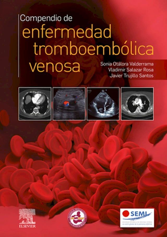  Compendio de enfermedad tromboembólica venosa(Kobo/電子書)