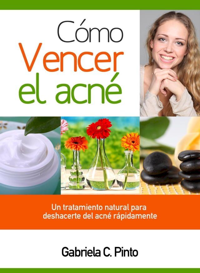  Cómo Vencer el Acné(Kobo/電子書)