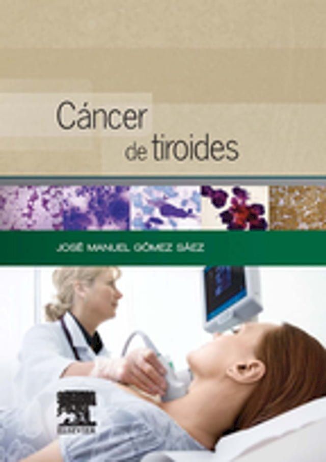  Cáncer de tiroides(Kobo/電子書)