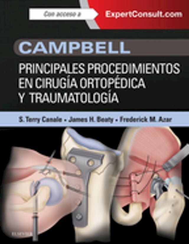  Campbell. Principales procedimientos en cirug&iacute;a ortop&eacute;dica y traumatolog&iacute;a(Kobo/電子書)