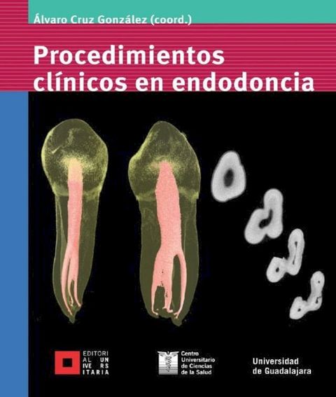 Procedimientos cl&iacute;nicos en endodoncia(Kobo/電子書)