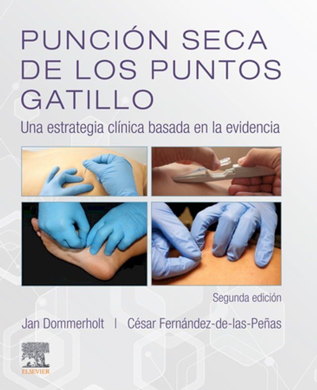  Punción seca de los puntos gatillo(Kobo/電子書)