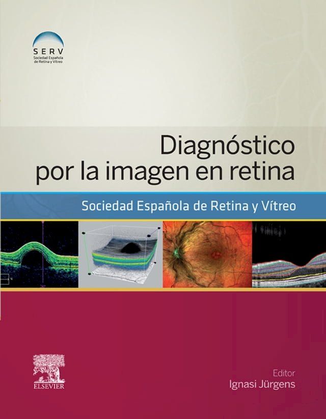  Diagnóstico por la imagen en retina(Kobo/電子書)