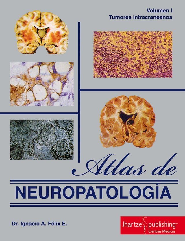  ATLAS DE NEUROPATOLOGÍA(Kobo/電子書)