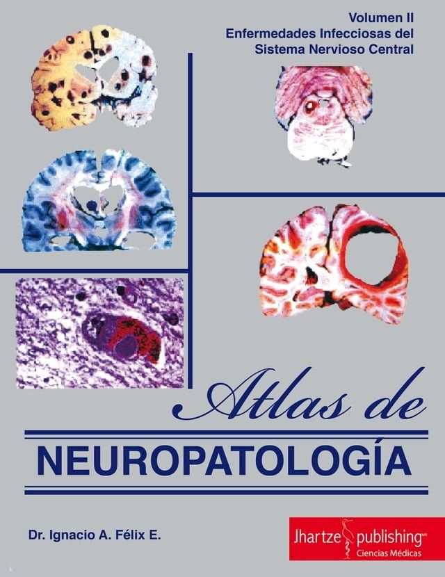  ATLAS DE NEUROPATOLOGÍA(Kobo/電子書)