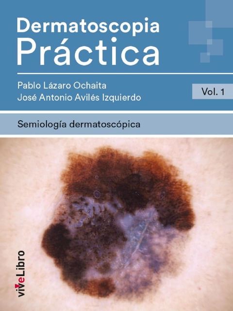 Dermatoscopia Pr&aacute;ctica. Vol. 1: Semiolog&iacute;a Dermatosc&oacute;pica(Kobo/電子書)