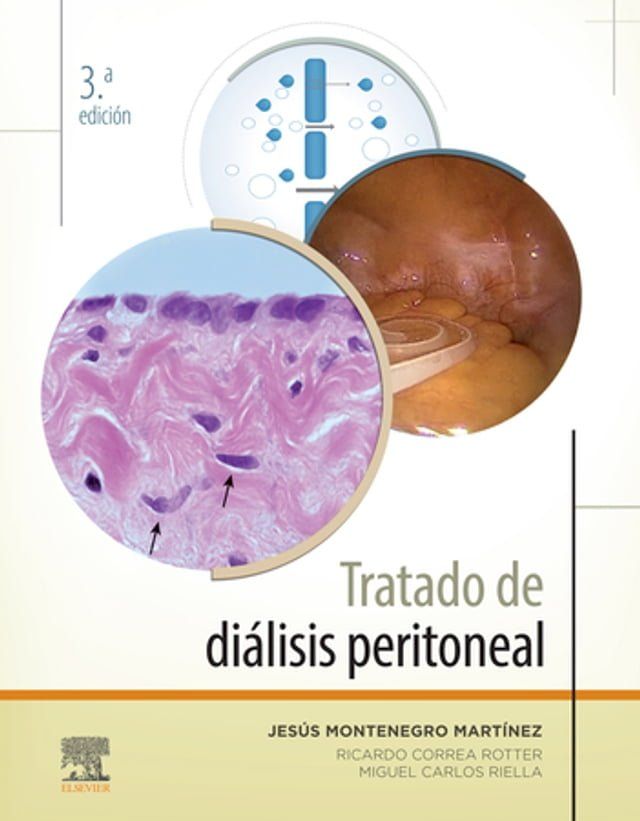  Tratado de diálisis peritoneal(Kobo/電子書)