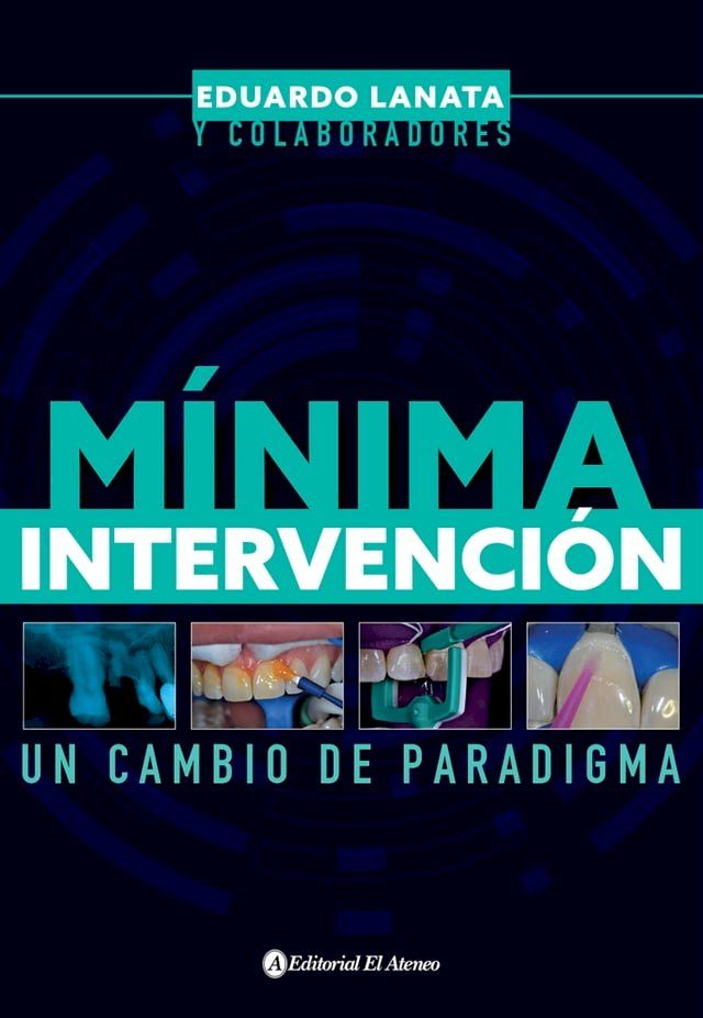  Mínima intervención(Kobo/電子書)