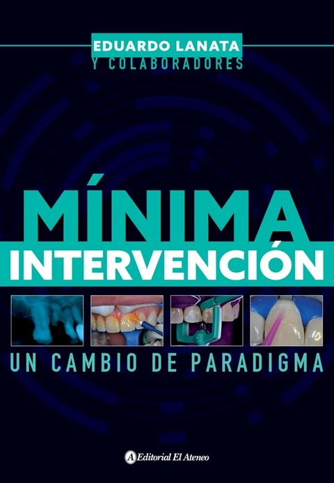 M&iacute;nima intervenci&oacute;n(Kobo/電子書)