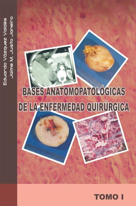 Bases Anatomopatol&oacute;gicas De La Enfermedad Quir&uacute;rgica(Kobo/電子書)