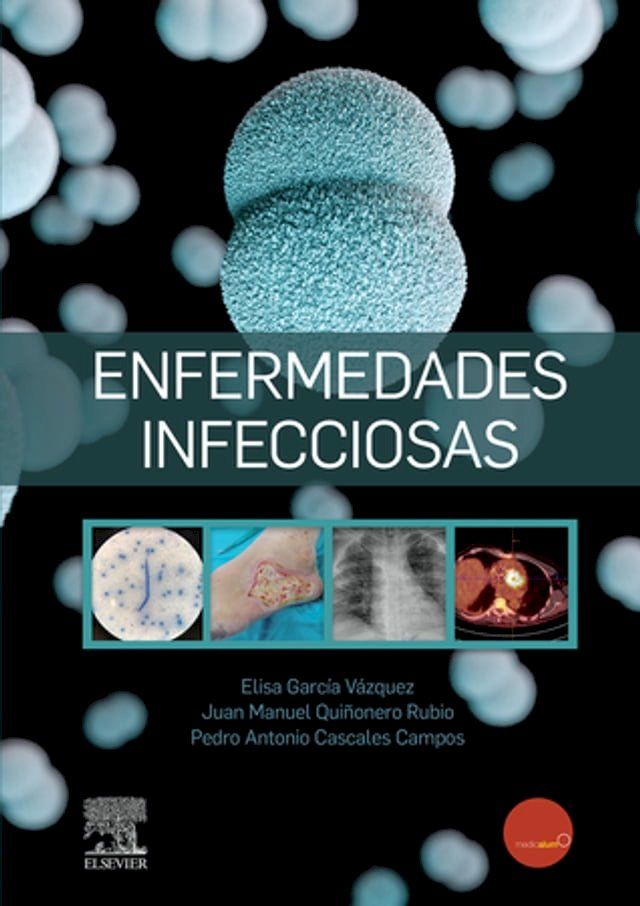  Enfermedades infecciosas(Kobo/電子書)