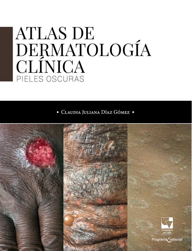  Atlas de dermatolog&iacute;a cl&iacute;nica(Kobo/電子書)