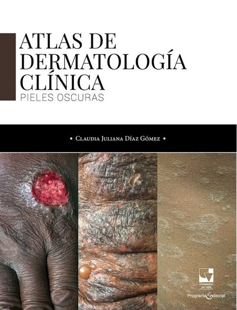 Atlas de dermatología clínica(Kobo/電子書)