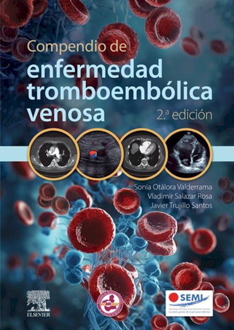 Compendio de enfermedad tromboemb&oacute;lica venosa(Kobo/電子書)