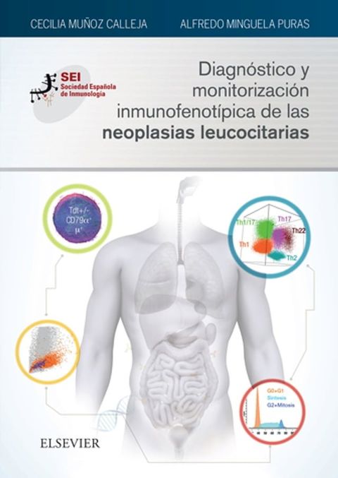 Diagnóstico y monitorización inmunofenotípica de las neoplasias leucocitarias(Kobo/電子書)